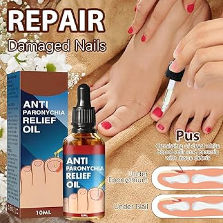 (1pcs) Jaysuing Anti Paronychia Relief Oil 10 Ml